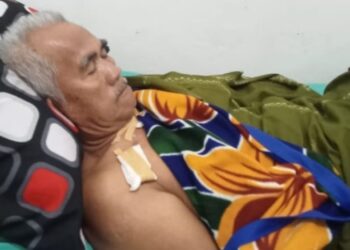 Terluka Parah! Warga Semaka Tanggamus Berduel Sengit dengan Buaya