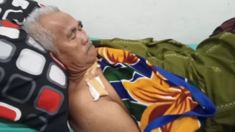 Terluka Parah! Warga Semaka Tanggamus Berduel Sengit dengan Buaya